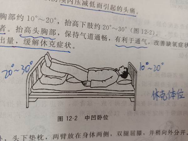 大S為何常臥？深度剖析其背后的多重原因與健康管理之道