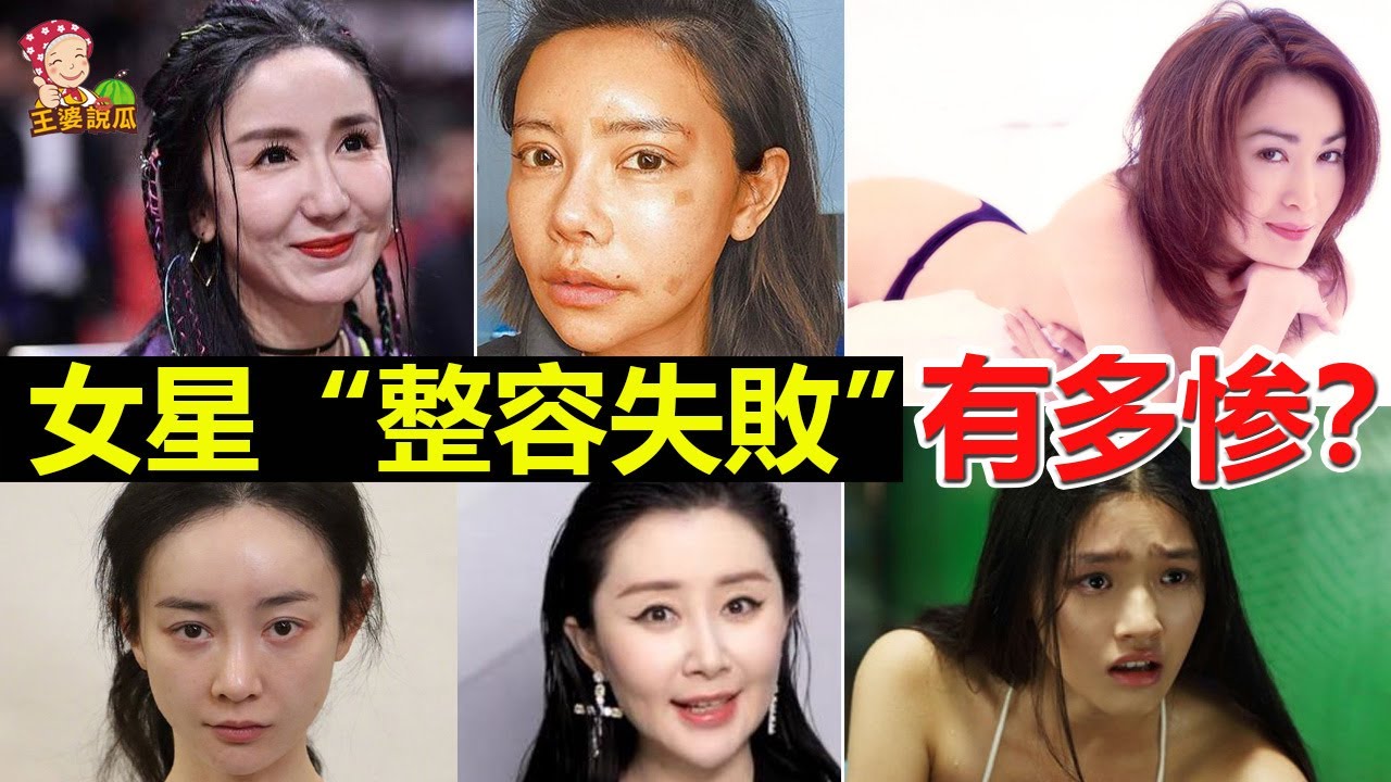 深度解析：整容很好看的女明星，如何做到自然美的典范？